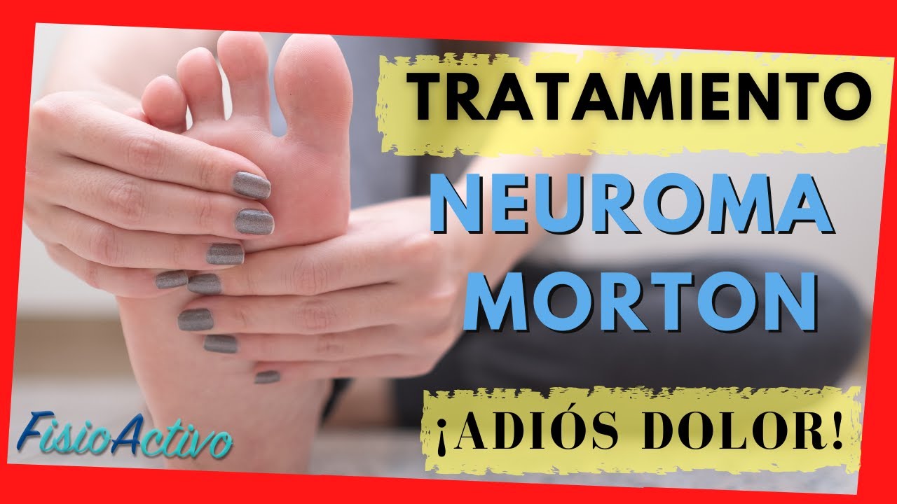 Como se Cura el Neuroma de Morton